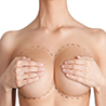 Raising the age limit for breast lipofiling 