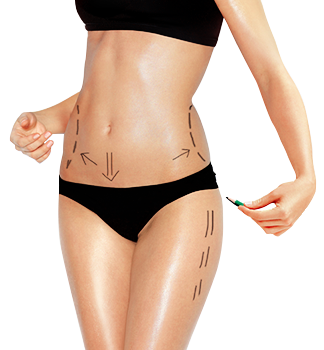 body contouring surgery abroad