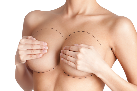 breast augmentation abroad