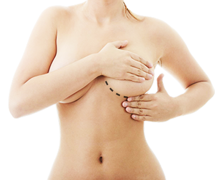 breast cosmetic surgery abroad