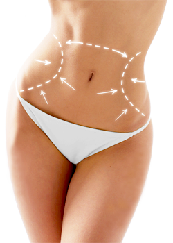 tummy tuck abroad