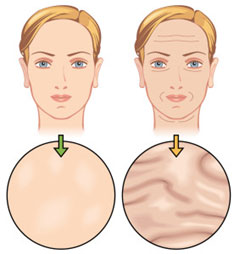 Botox-injections-Tunisia