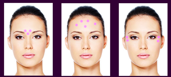 Other-areas-Botox-injections