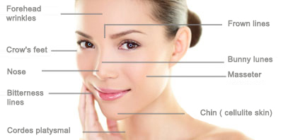 areas-Botox-injections