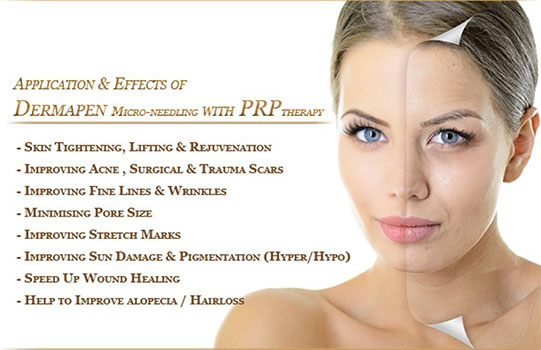 Objectives-PRP-treatment-face-in