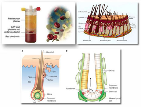 Objectives-PRP-treatment-scalp-Tunisia