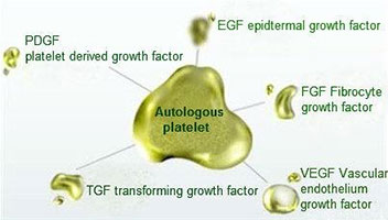 PRP-Platelet-rich-growth-factors