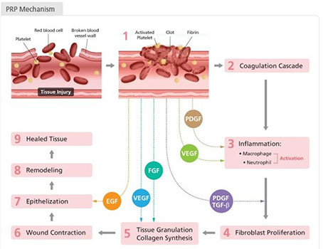 PRP-Virtues-regenerating-platelets